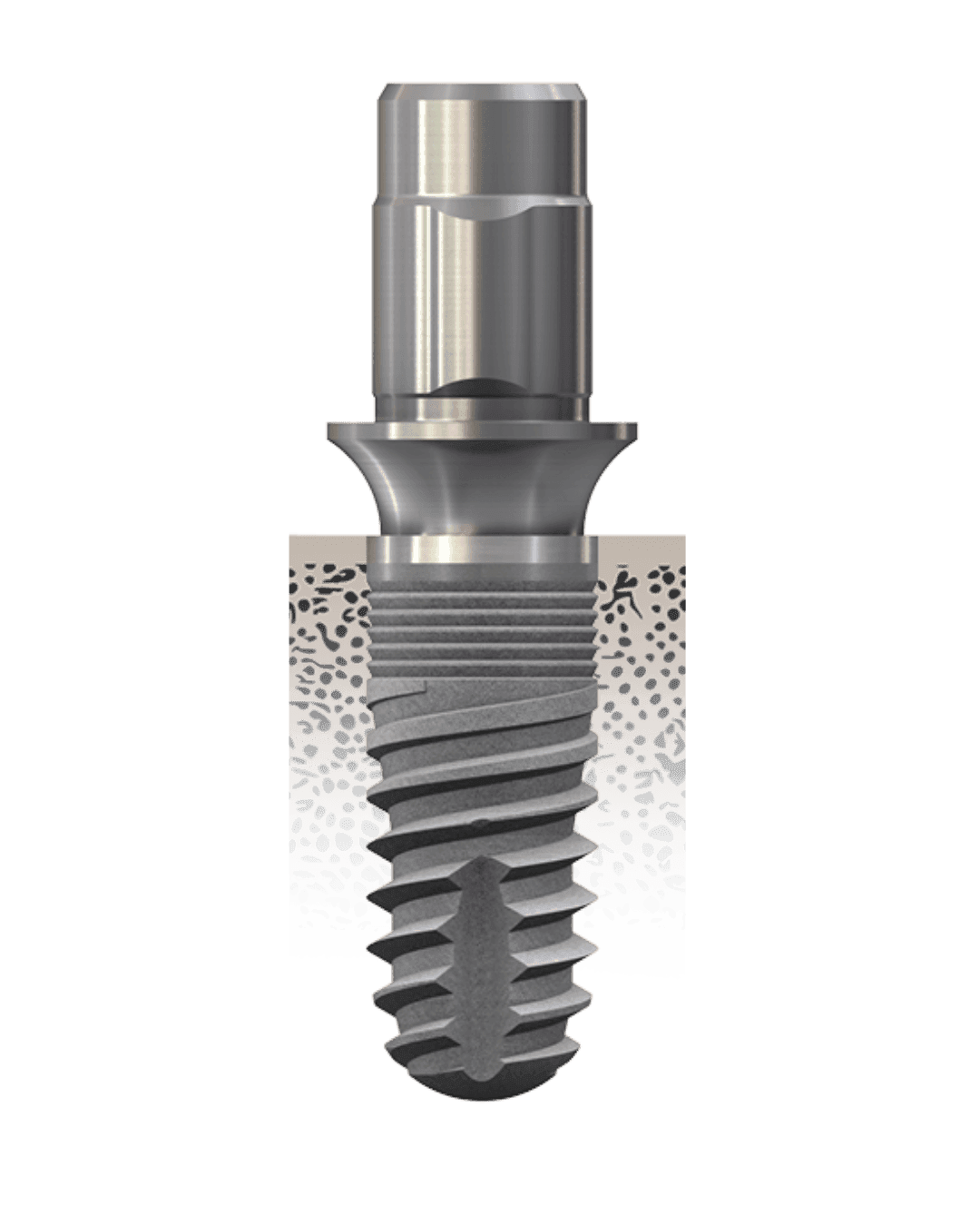 BlueSKY implantátumrendszer – Hero image