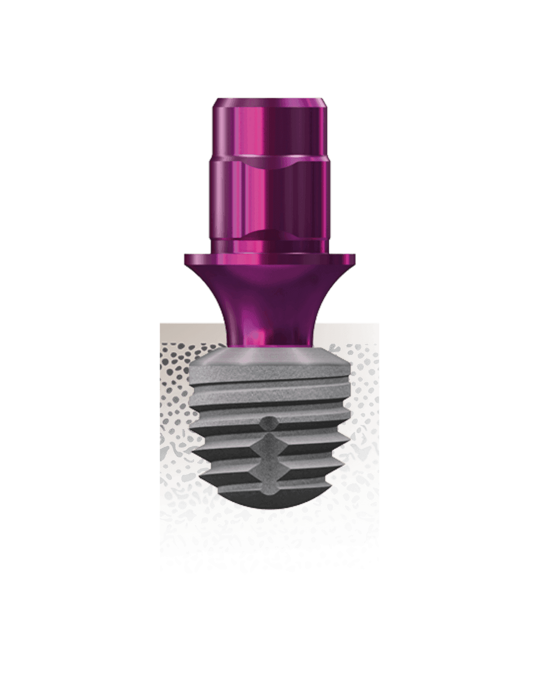 copaSKY ultra short implantátum – Hero image