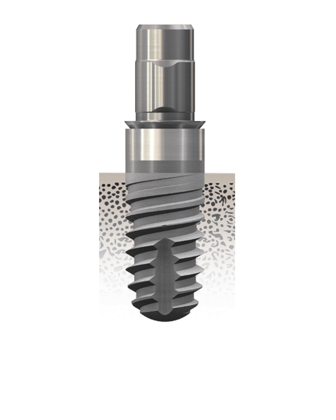 classicSKY implantátumrendszer – Hero image