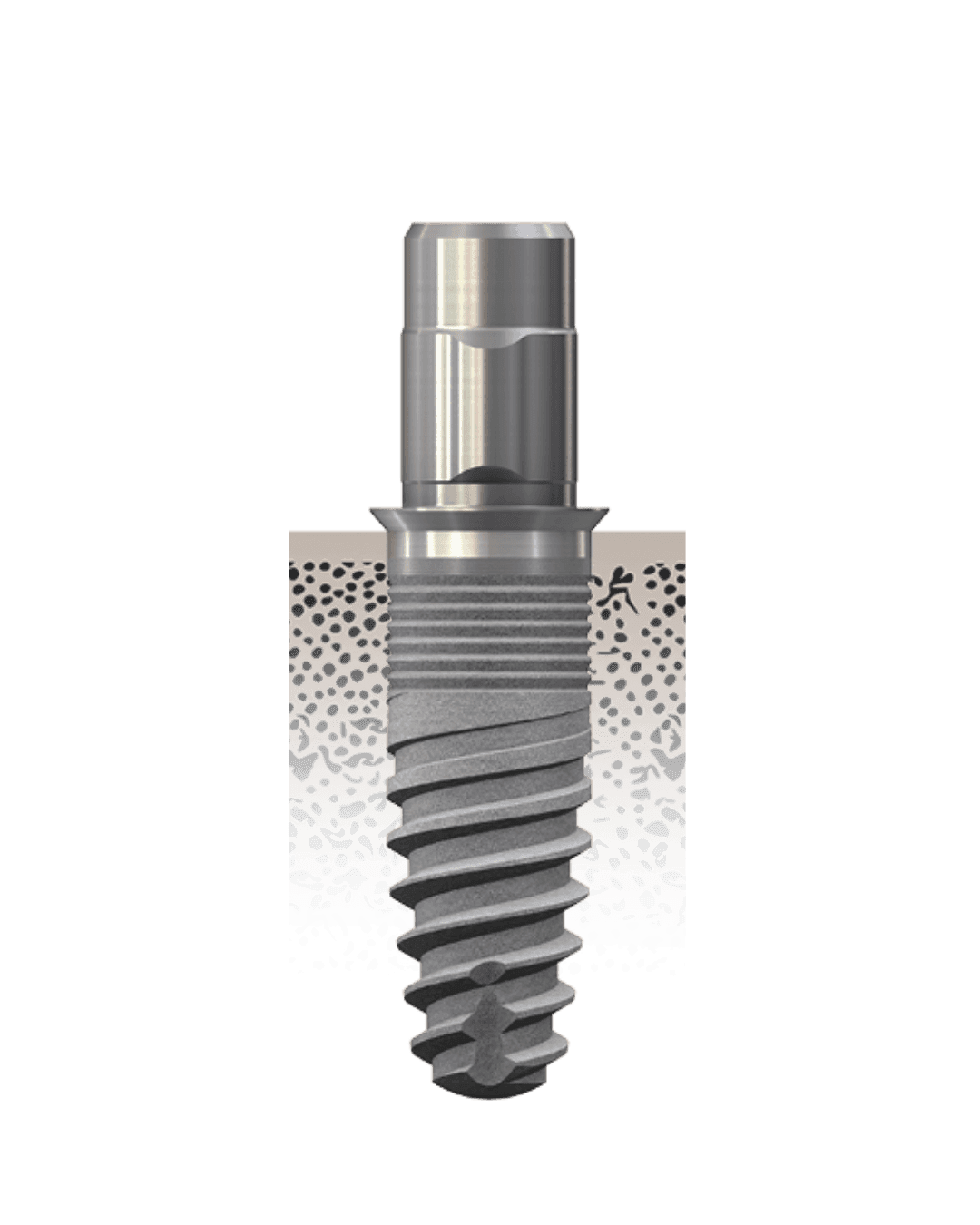 narrowSKY implantátumrendszer – Hero image
