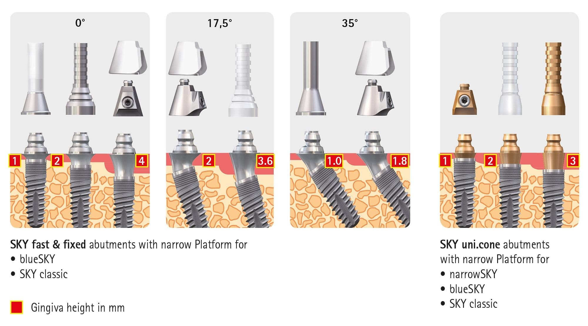 Uni.cone és fast & fixed felépítmények a SKY fast & fixed terápiához – Photo