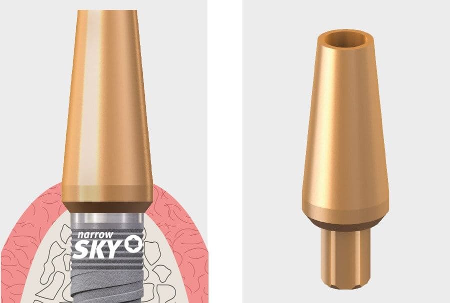 Standard gyártmánycsalád felépítményei – Photo